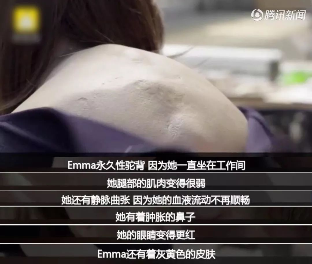 科学家模拟“久坐族20年后的样子”！看完这个视频我有点慌！