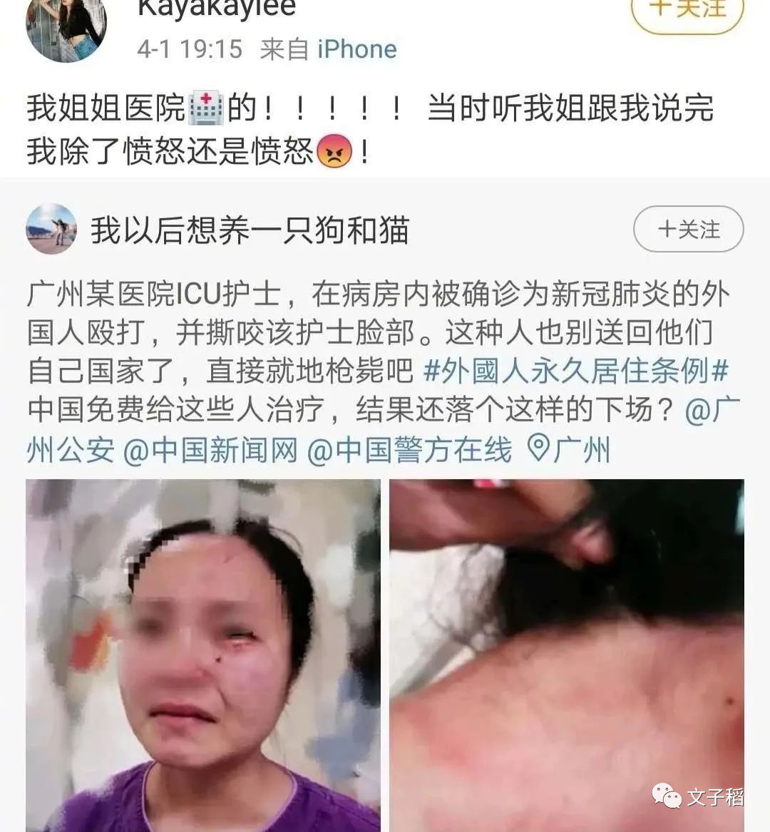 殴打咬伤女护士，叫嚣“中国人出去”！鬼佬为何能在中国嚣张？