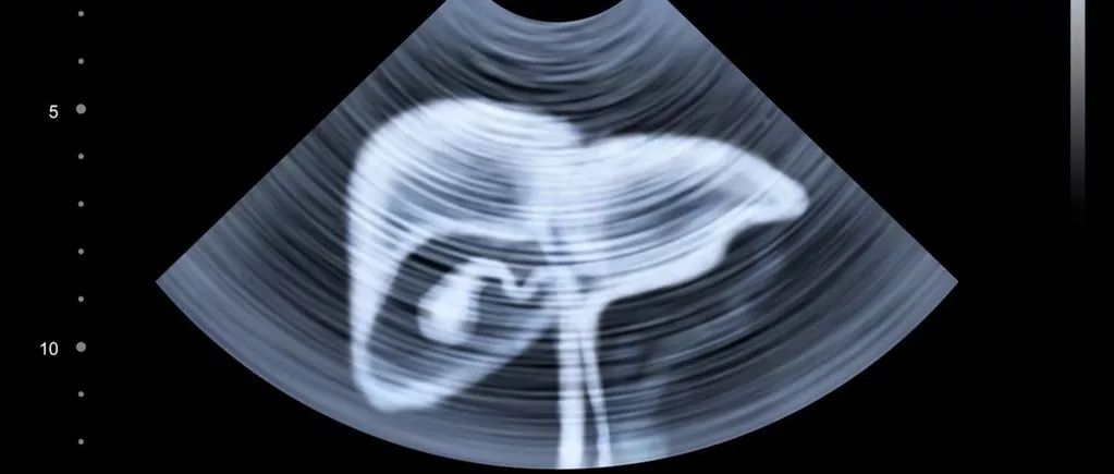 比起“新冠”，这4种病毒不仅擅长伪装，还可能致癌！