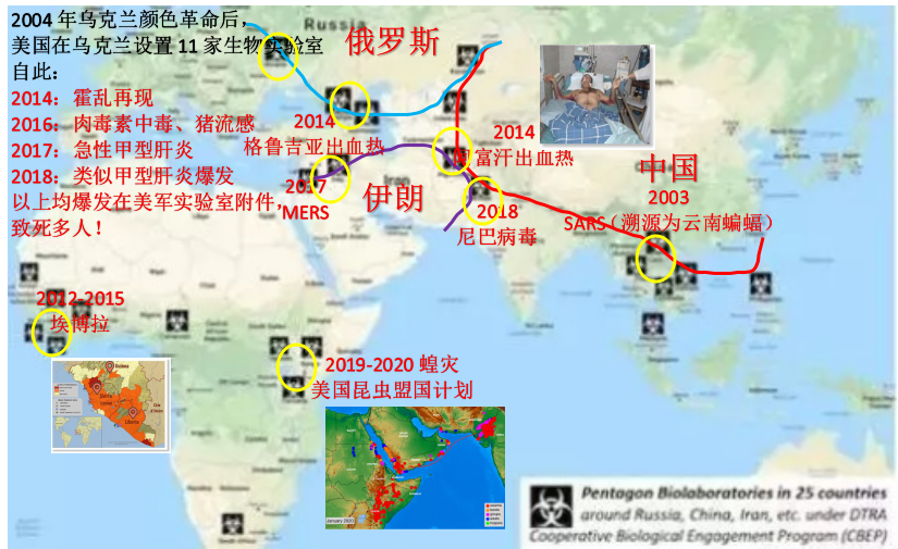 全球布点、泄露致命病毒，美国欠世界一个解释！