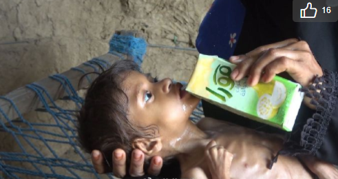 新冠全球已死50万，也门可能被抹去？未来全球会有多惨？