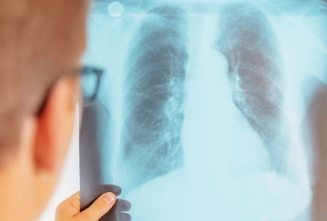 每个人身上都可能有「结节」！一张表判断它是良性or恶性！