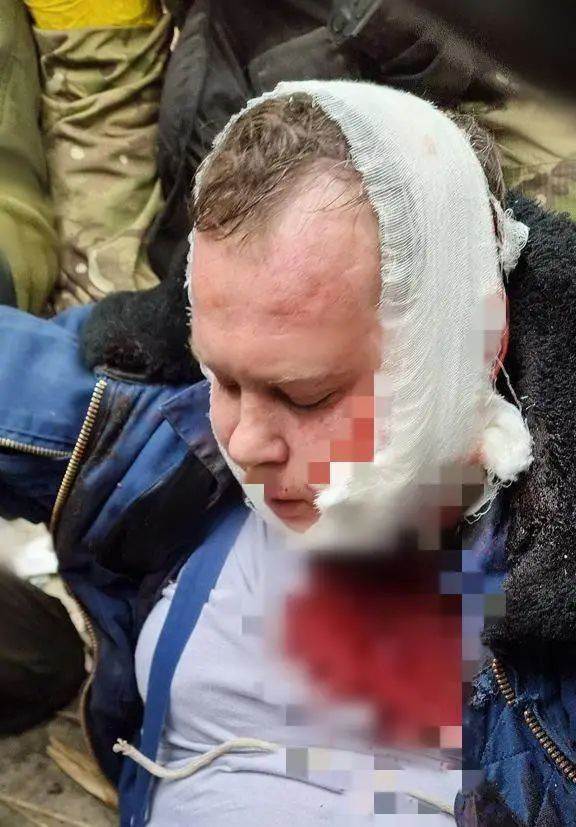 俄乌战争：几条战线上的生死搏杀！