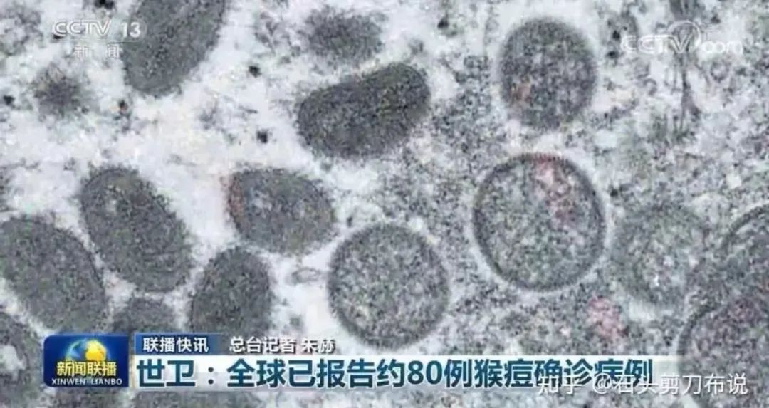 从支持日本入常到进行猴痘疫情演习，法西斯化的美国应引起我们高度警觉！