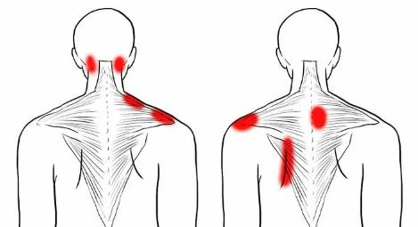 “拉筋”拉的到底是什么？不同人群各有「最佳拉伸法」！