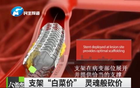 医药集采再出重拳，能砸烂多少人层层盘剥的金饭碗？