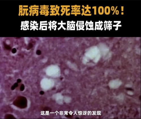 能抵抗朊病毒的PRNP基因，欧美人比中国人高20倍！